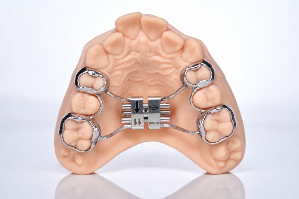 orthodontic expander for arch expansion in orthodontics